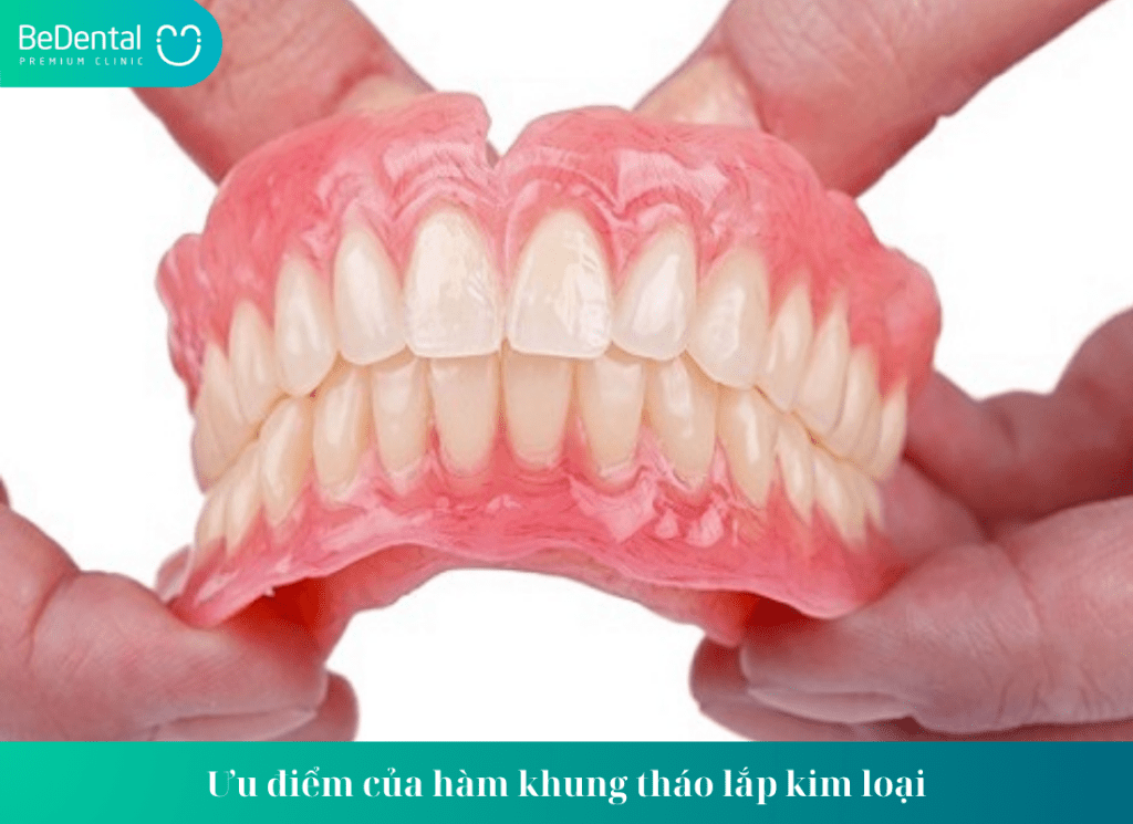 Ưu điểm của hàm khung tháo lắp kim loại