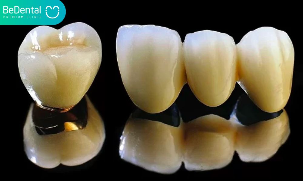 Răng giả cao cấp loại nào tốt nhất?