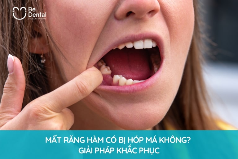 Mất Răng Hàm Có Bị Hóp Má Không? Giải Pháp Khắc Phục