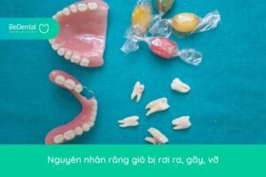 Nguyên nhân và cách khắc phục răng giả bị rơi ra
