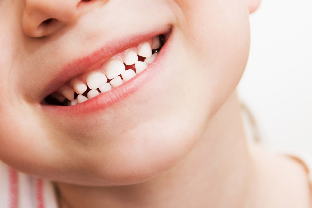 phân biệt răng sữa và răng vĩnh viễn