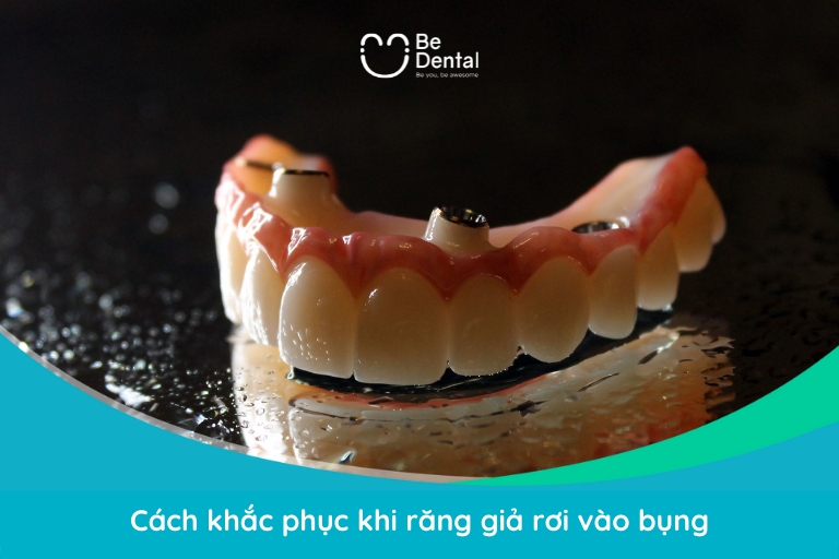Khi răng giả rơi bụng, bạn nên quan sát phân, theo dõi trạng thái cơ thể và tới bác sĩ để thăm khám