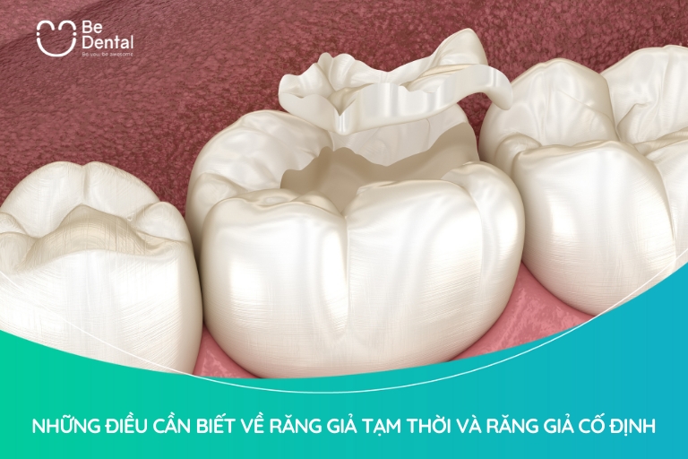 Những Điều Cần Biết Về Răng Giả Tạm Thời Và Răng Giả Cố Định