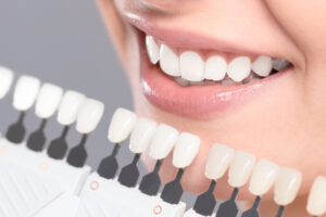 teeth whitening