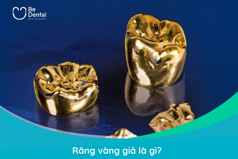 Răng vàng giả là chiếc răng được chế tác từ hợp kim như Palladium, Platin, vàng