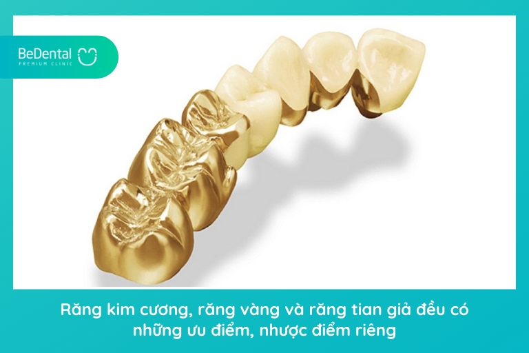 Dù làm từ chất liệu nào thì răng vàng giả, răng kim cương hay răng titan đều có ưu nhược điểm riêng