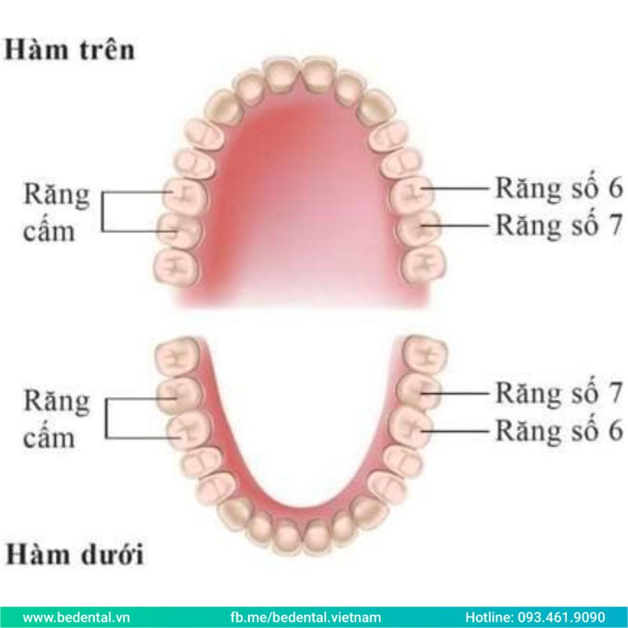 Răng hàm có mọc lại không? Giải đáp chi tiết từ chuyên gia nha khoa 2 Răng hàm có mọc lại không? Giải đáp chi tiết từ chuyên gia nha khoa