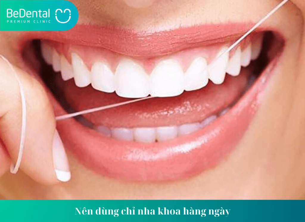 Nên dùng chỉ nha khoa hàng ngày