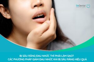 Bị Sâu Răng Đau Nhức Thì Phải Làm Sao? Tổng Hợp Các Phương Pháp Giảm Đau Nhức Khi Bị Sâu Răng Hiệu Quả