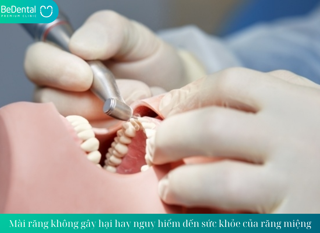 Mài răng có ảnh hưởng gì về lâu dài không?