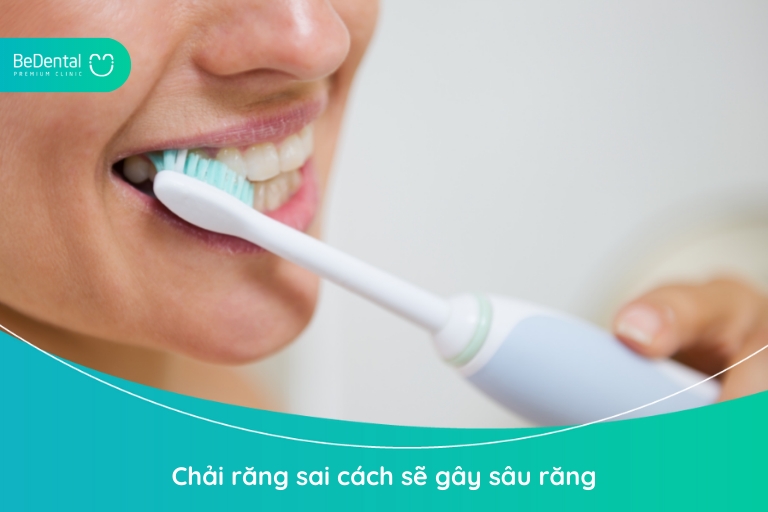 Chải răng sai cách sẽ gây sâu răng dù bạn có thói quen đánh răng thường xuyên