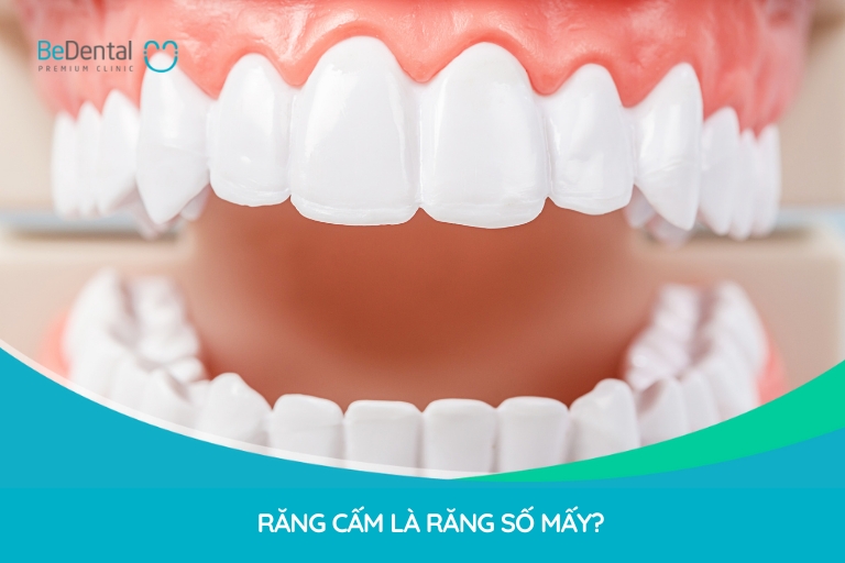 Răng cấm là thuật ngữ chỉ chiếc răng hàm số 6 và số 7