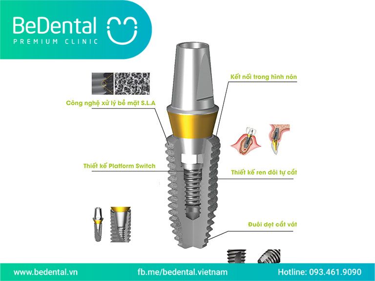 trồng răng implant 