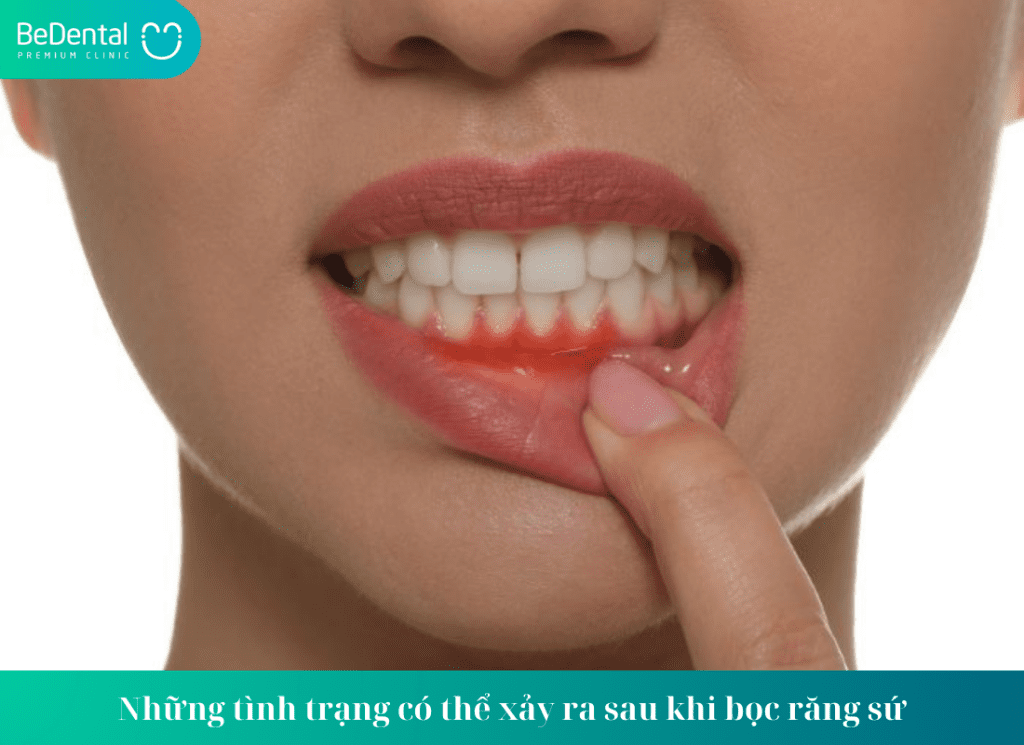 RĂNG SỨ THÁO RA CÓ LÀM LẠI ĐƯỢC KHÔNG - Quá trình tháo răng sứ có đau không