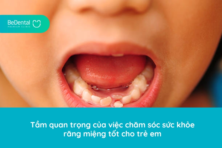 Tầm quan trọng của việc chăm sóc sức khỏe răng miệng tốt cho trẻ em