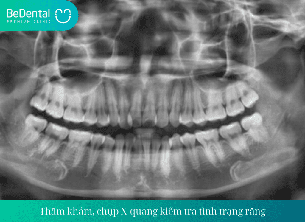 Thăm khám, chụp X-quang kiểm tra tình trạng răng