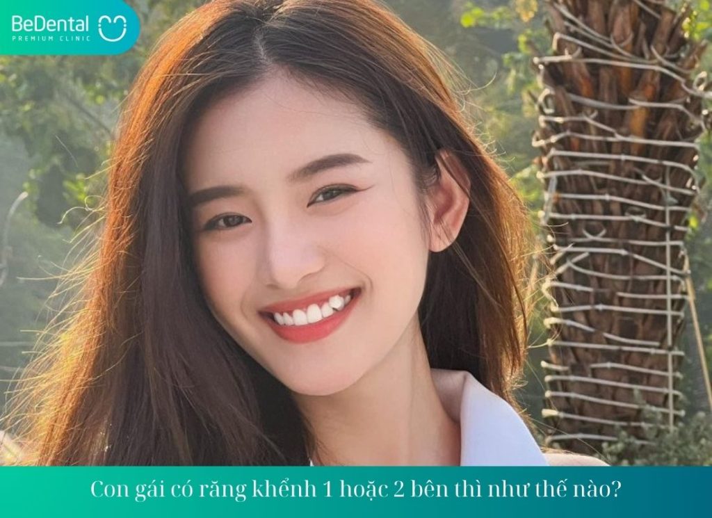 Con gái có răng khểnh 1 hoặc 2 bên thì như thế nào?