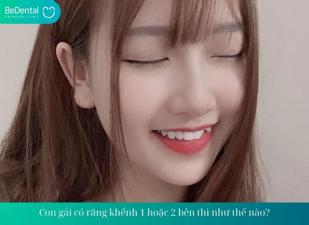 Con gái có răng khểnh 1 hoặc 2 bên thì như thế nào?