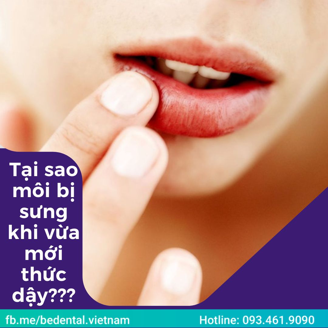 Dị ứng với một số loại thuốc cũng có thể khiến sưng môi sau khi ngủ dậy.