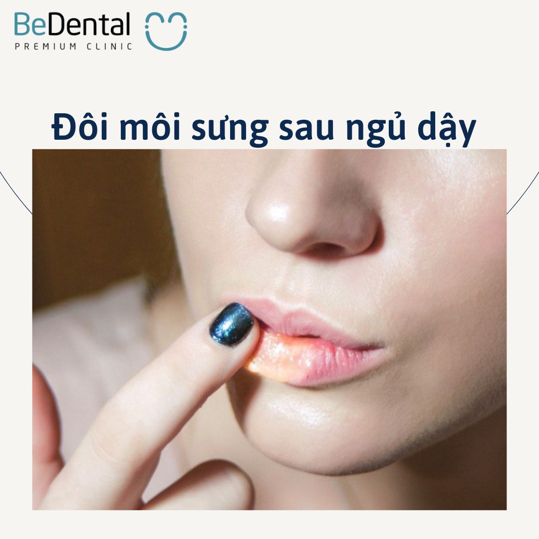 Tại sao của bạn bị sưng môi khi mới thức dậy?