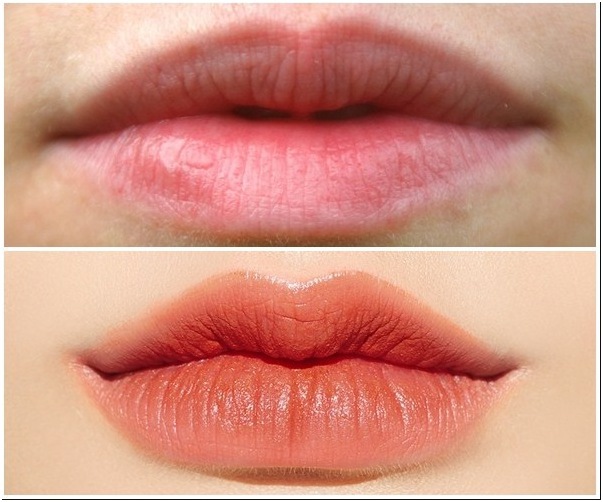 How to have natural heart lips without surgery