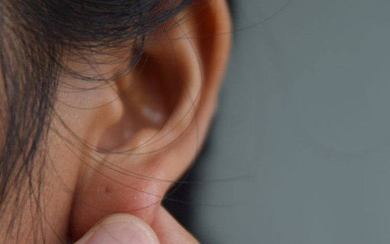 Tiêm filler tạo tướng tai giống phật cải thiện khuyết điểm ở đôi tai