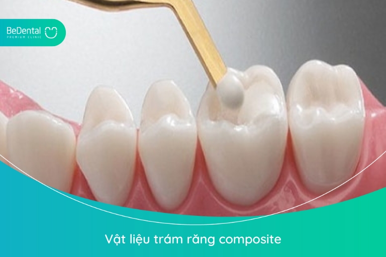 Vật liệu trám răng composite