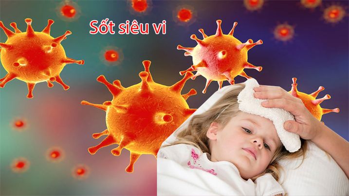 Trẻ thường bị sốt cao khi bị sốt siêu vi