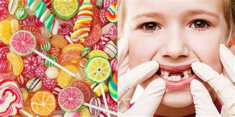 Bé sún răng chủ yếu do ăn nhiều kẹo và tinh bột.