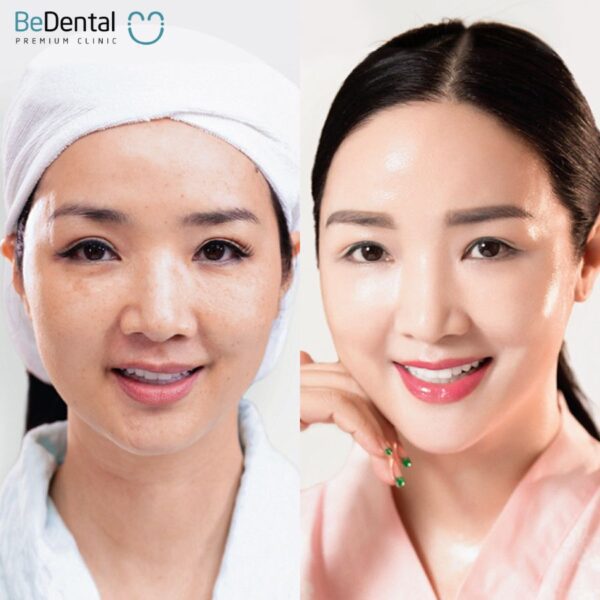 Râu rồng là gì? Tướng số của người râu rồng. 7 cách xóa mờ đường râu ...