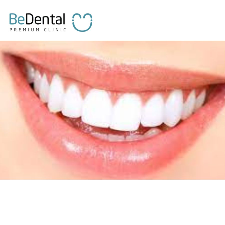 Tự tin cười nói khi có một hàm răng trắng đẹp