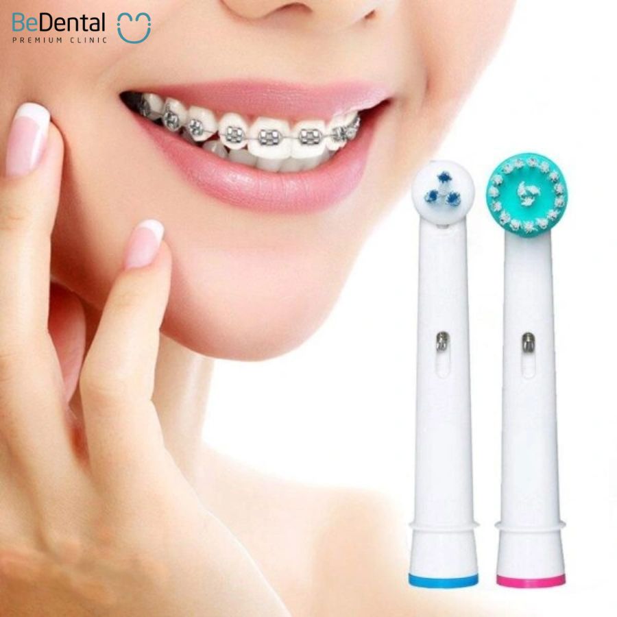 Bàn chải đánh răng bằng điện rất thích hợp cho người mang niềng răng