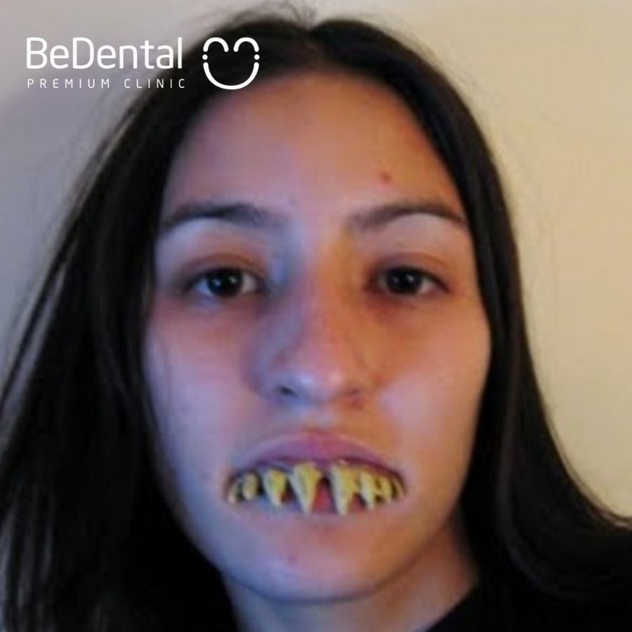 Hình ảnh hàm răng xấu của cô nàng