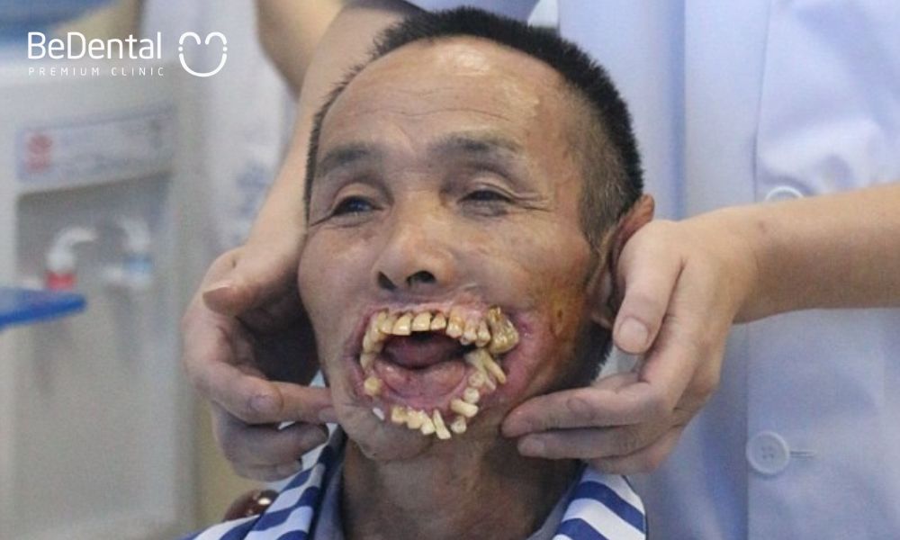 Hình ảnh hàm răng xấu của ông Wu khi nhìn vào sẽ khiến nhiều người có cảm giác “nổi da gà”