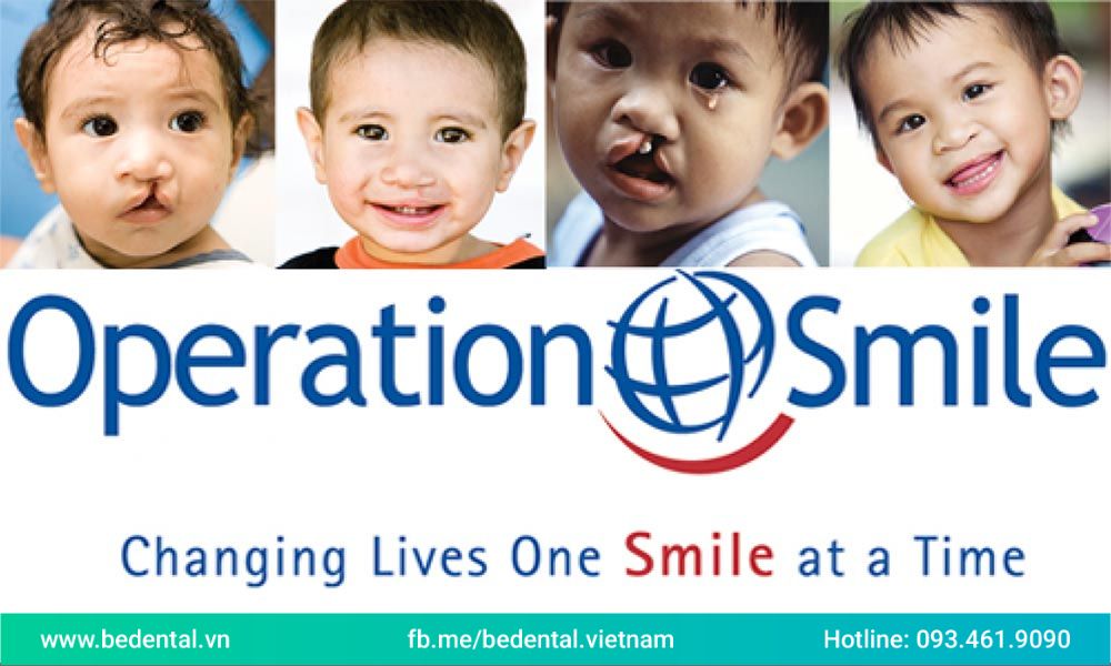 Đây là tổ chức có tên gọi khác là phẫu thuật nụ cười – một tổ chức nhân đạo quốc tế sáng lập từ năm 1982 ở Hoa Kỳ. Operation Smile đã thực hiện hàng ngàn ca phẫu thuật sứt môi và hở hàm ếch cho các trẻ em không may mắn khi bị những dị tật bẩm sinh trên toàn thế giới. 
