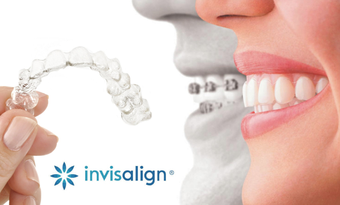 invisalign page 17