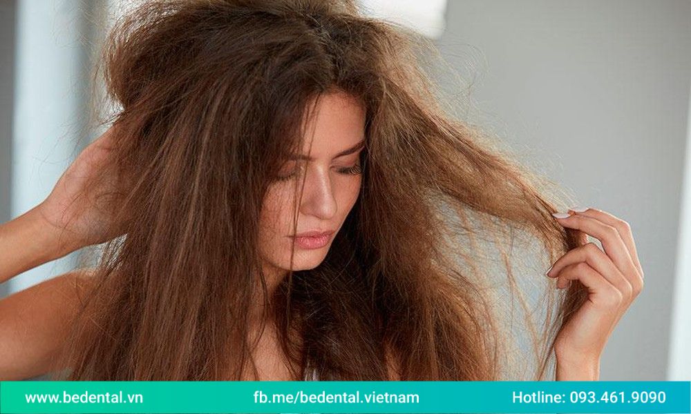 Có nhiều nguyên nhân khiến tóc xơ rối như thiếu độ ẩm, tóc khô, ngủ xõa tóc,…