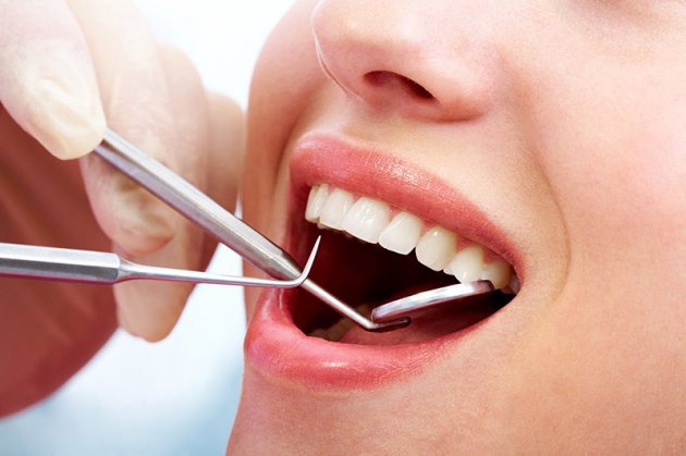 Nên đến nha khoa 6 tháng/ lần để được thăm khám răng miệng và lấy cao răng định kỳ
