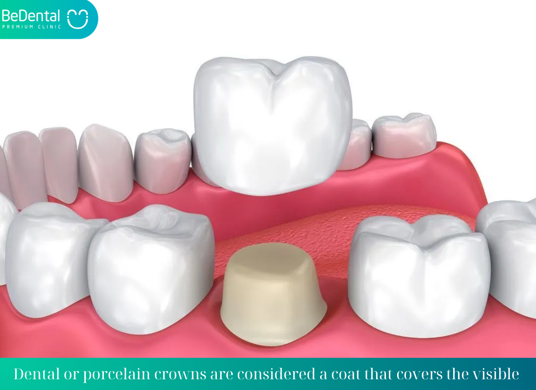 Dental crowns