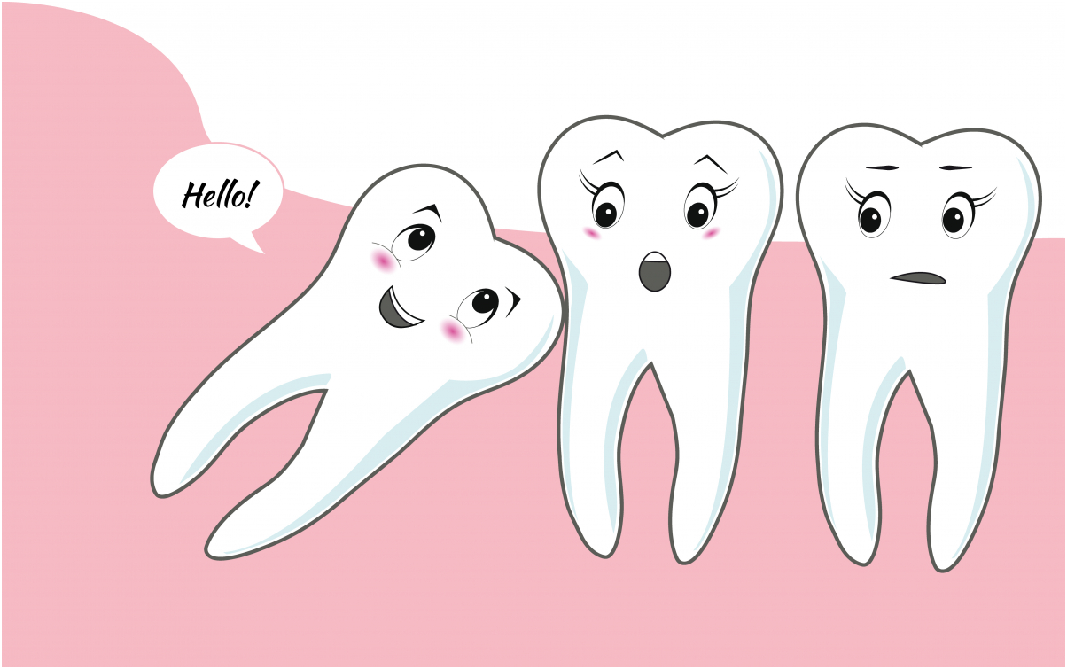 Mọc răng khôn, nhổ răng khôn là gì? 7 điều cần biết về răng khôn.
