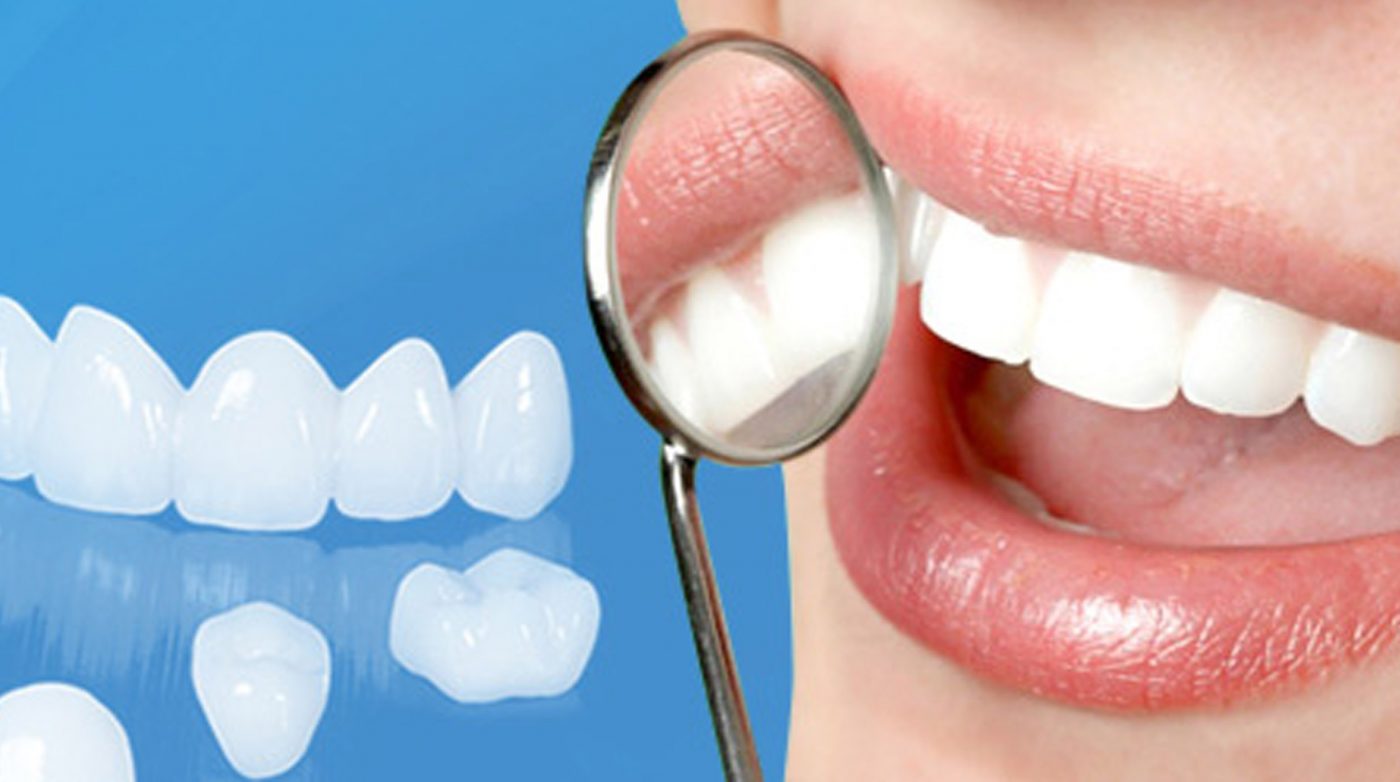 Làm cầu răng sứ sử dụng được bao lâu?
