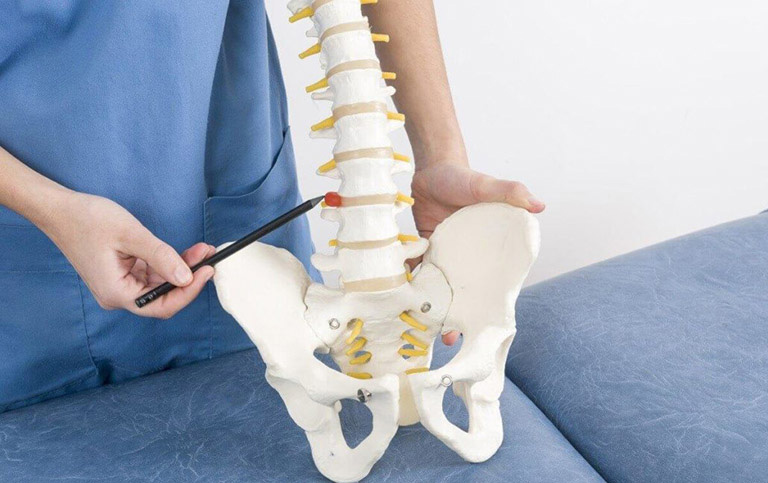 Cột sống ở thắt lưng bị thoái hóa khiến người bệnh di chuyển khó khăn với tư thế cong vẹo hoặc gù lưng