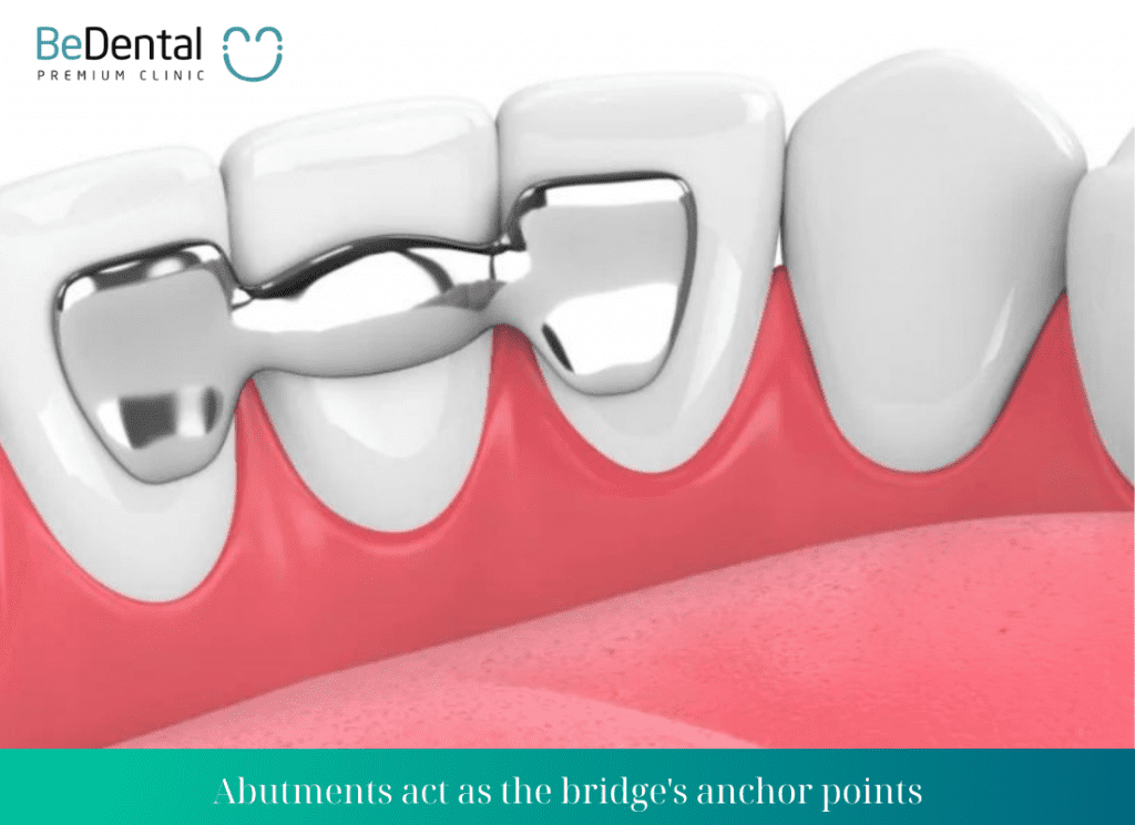 Abutments act as the bridges anchor points