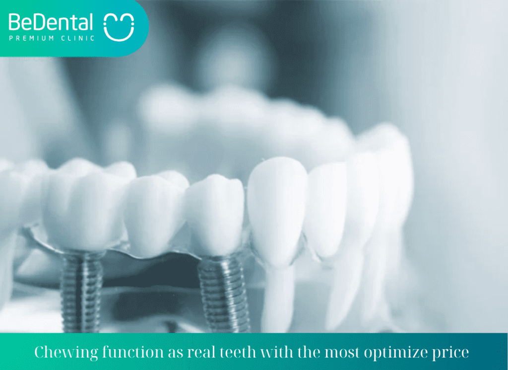 Chewing function as real teeth with the most optimize price