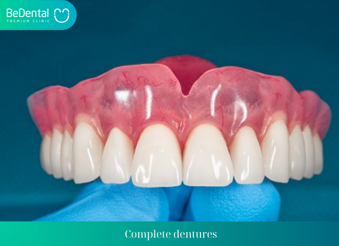 Complete dentures