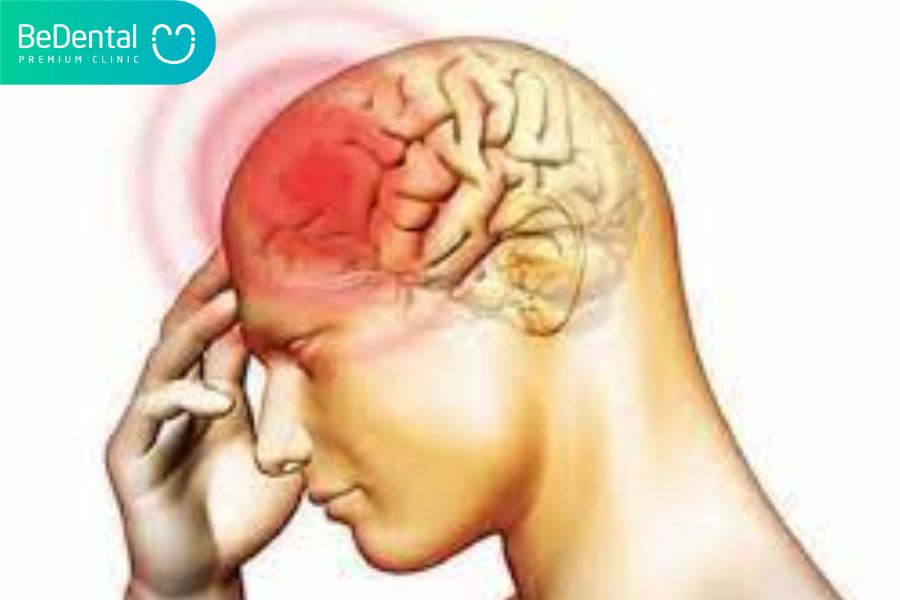 Đau đầu gây ra bởi khối u não