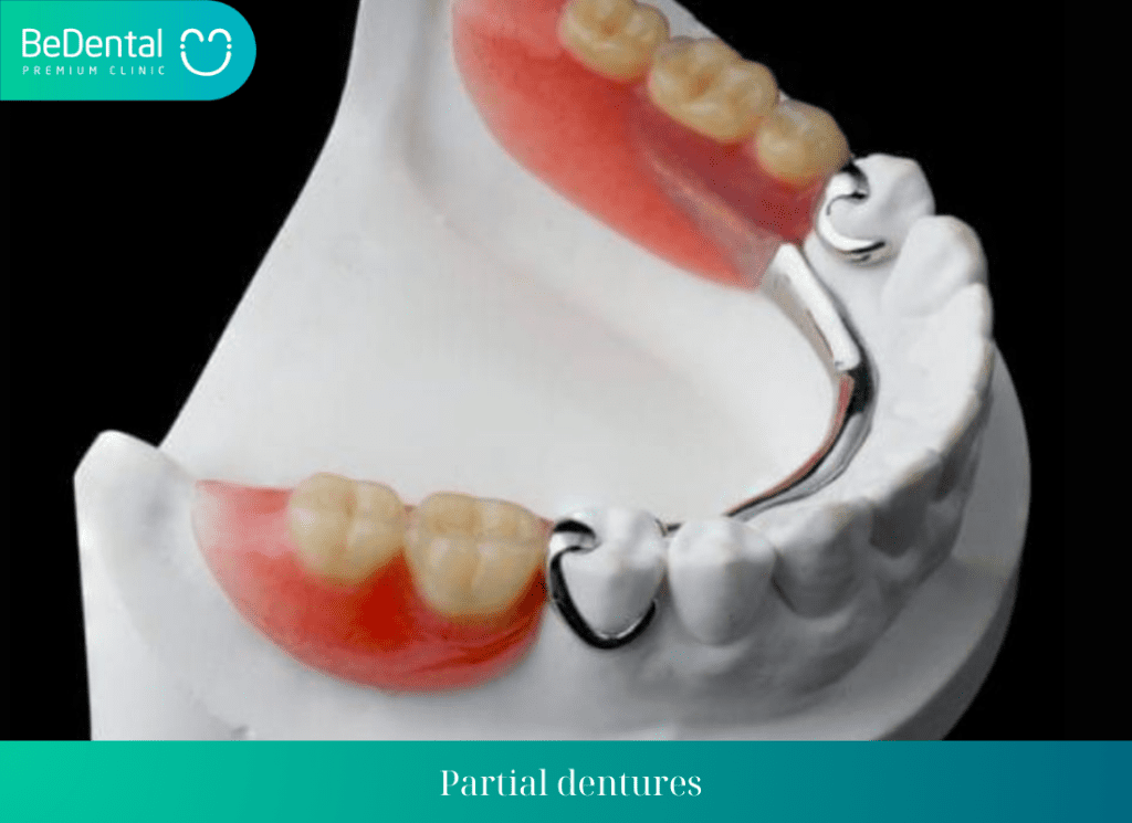 Partial dentures