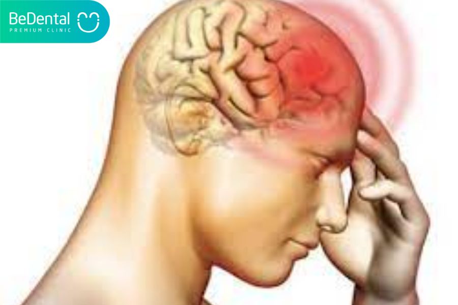 Chấn thương sọ não có thể gây đau đầu buồn nôn