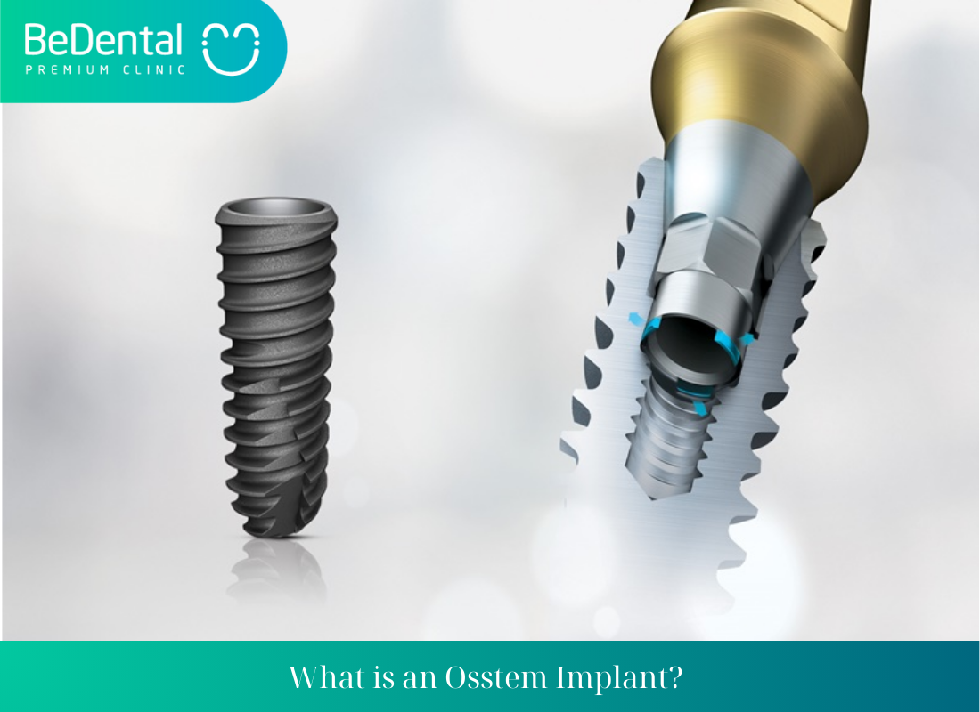 What is an Osstem Implant