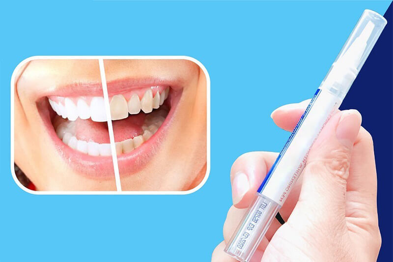 Bút tẩy trắng răng giúp khắc phục tình trạng răng xỉn màu